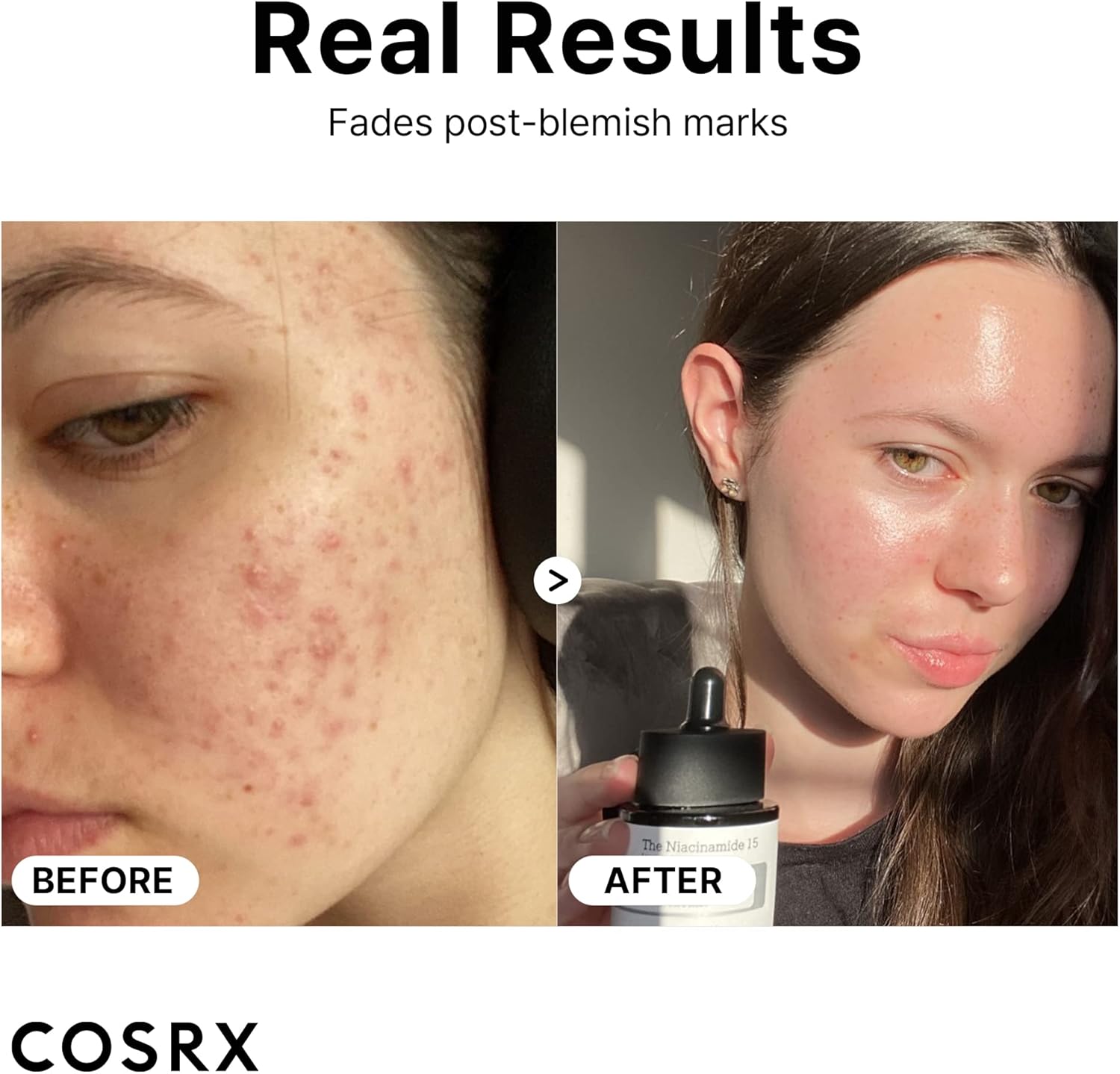 COSRX The Niacinamide 15 Serum 20ml