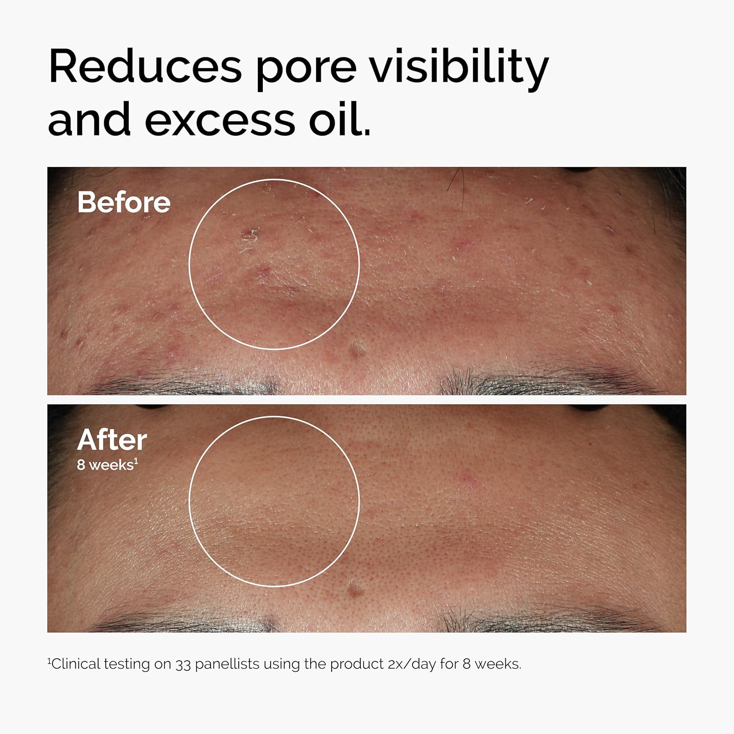 The Ordinary Niacinamide 10% + Zinc 1% - 30 ml, 769915190311